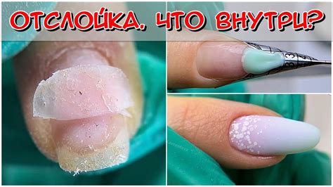 Предварительные меры для очистки поверхности гель-лака от пигментных следов, вызванных куркумой