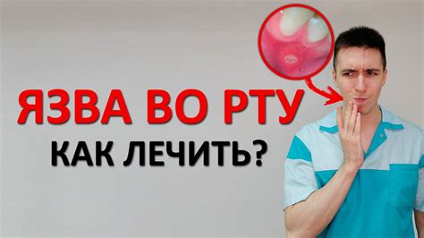 Снятие ощущения липкости во рту и облегчение симптомов