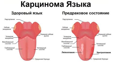 Феномен вязкости в полости рта и его связь с употреблением хурмы